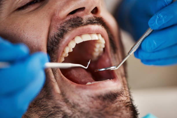 Best Chipped Tooth Repair Near Me  in South Waverly, PA